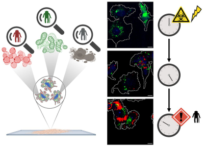 Therapy-induced senescent" (TIS) cells in treated tumour cells Therapy-induced senescent" (TIS) cells in treated tumour cells